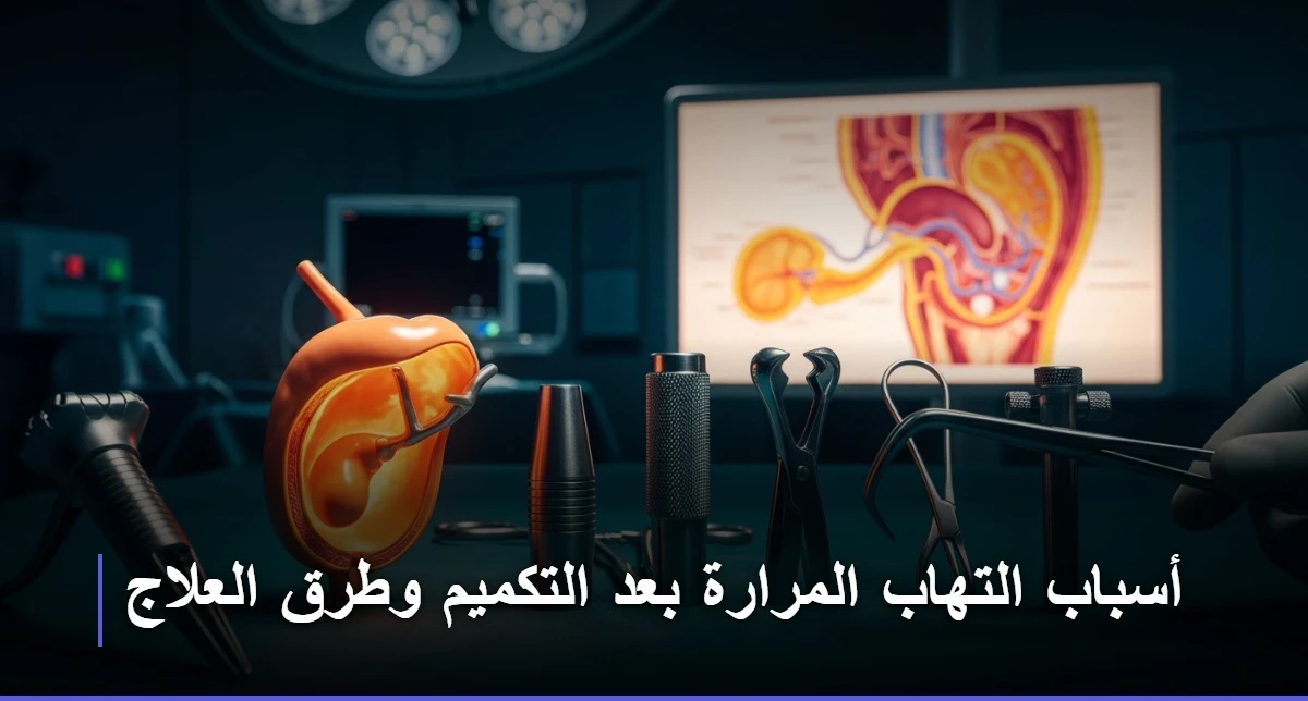 أسباب التهاب المرارة بعد التكميم
