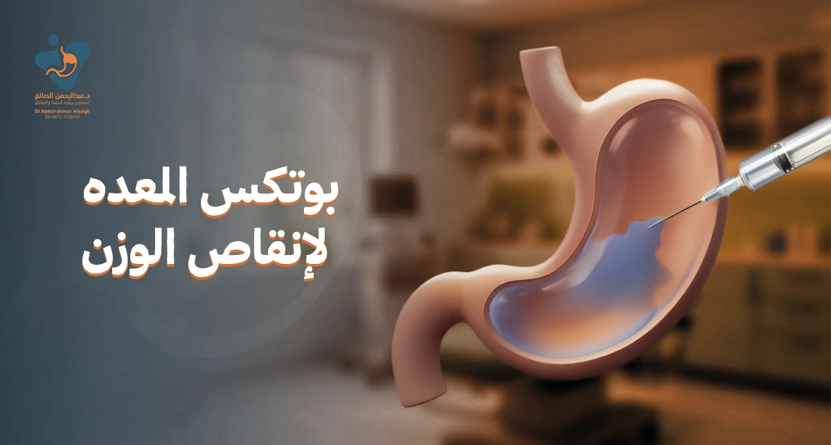 بوتكس المعده لانقاص الوزن