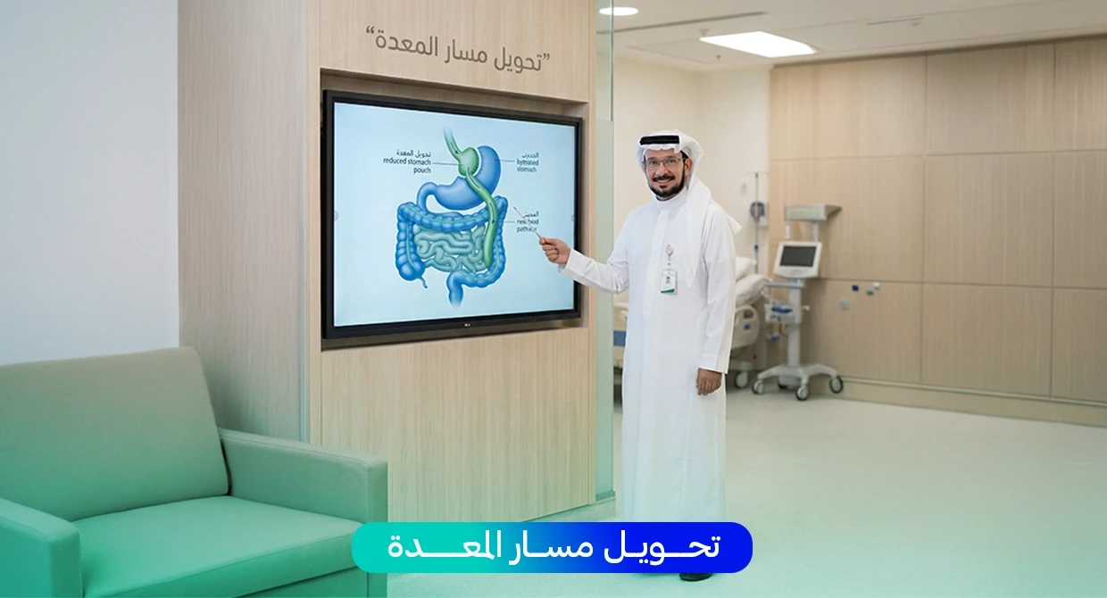 تحويل مسار المعدة الحل النهائي للسمنة