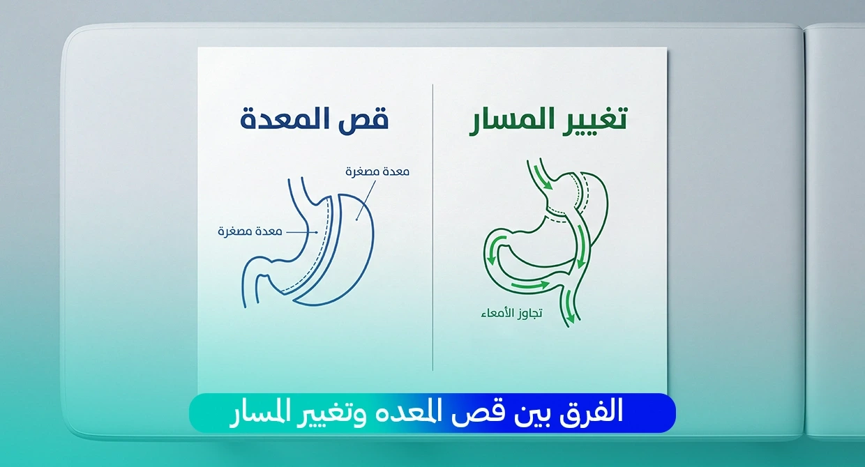 الفرق بين قص المعدة وتغيير المسار أيهما يناسبك؟