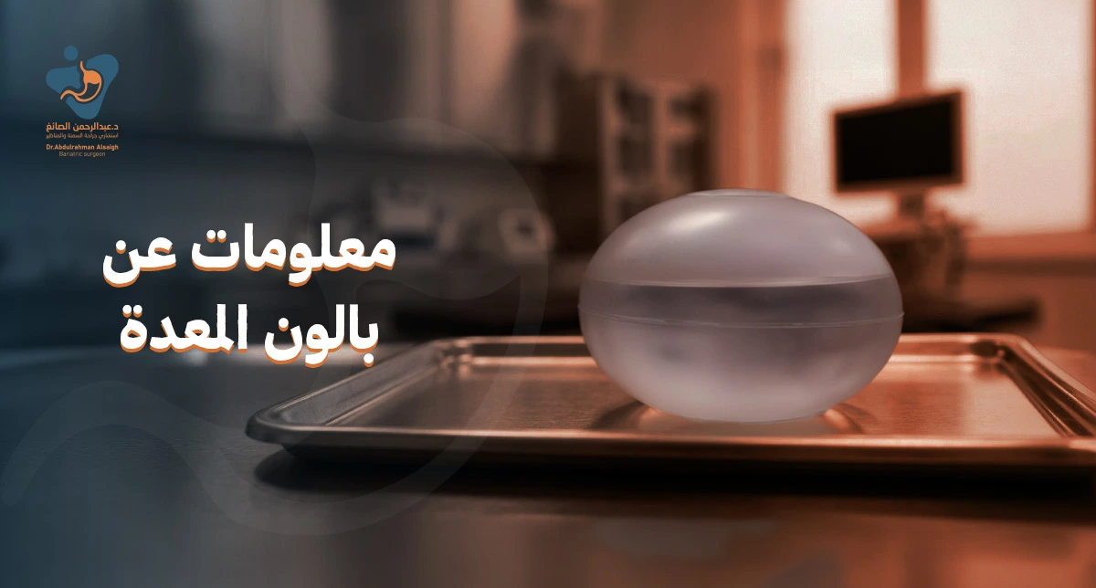 معلومات عن بالون المعدة